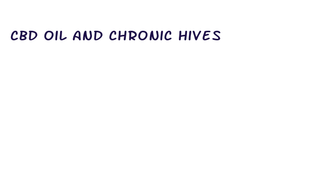 cbd oil and chronic hives