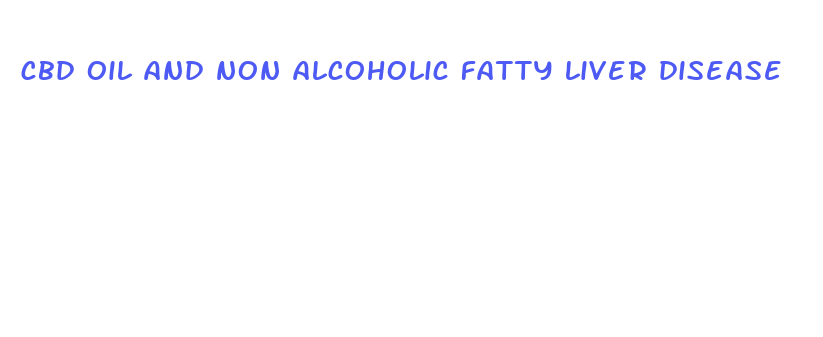 cbd oil and non alcoholic fatty liver disease