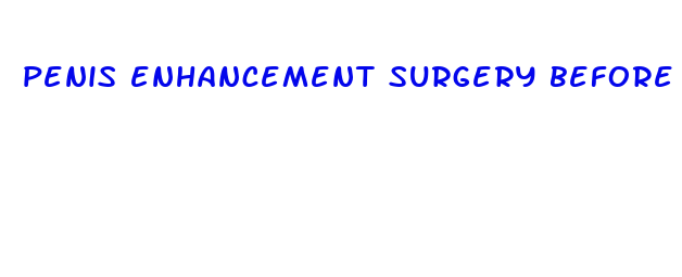 penis enhancement surgery before and after