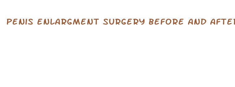 penis enlargment surgery before and after