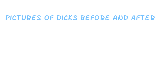 pictures of dicks before and after penus pills