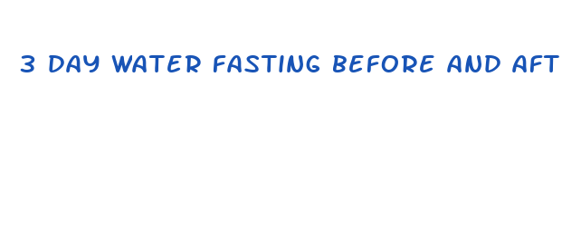 3 day water fasting before and after