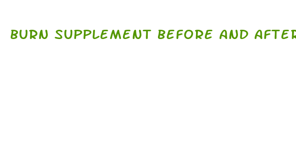 burn supplement before and after