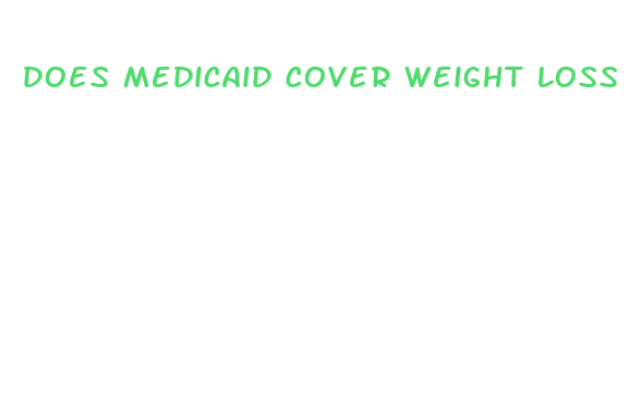 does medicaid cover weight loss