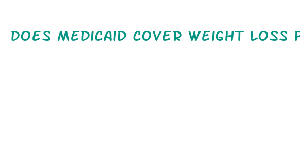 does medicaid cover weight loss programs