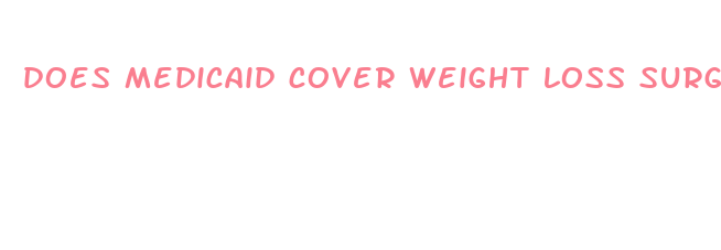 does medicaid cover weight loss surgery in michigan