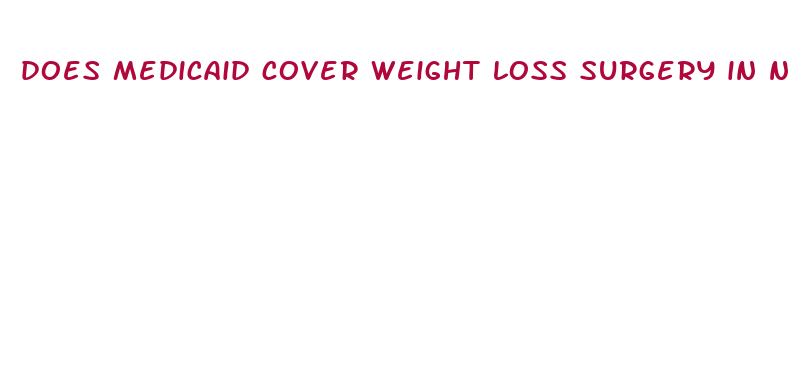 does medicaid cover weight loss surgery in nevada