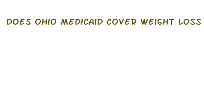 does ohio medicaid cover weight loss medication