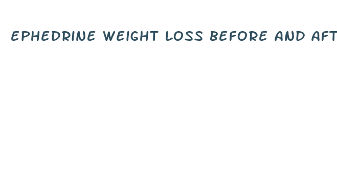 ephedrine weight loss before and after