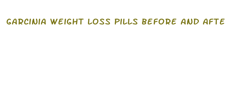 garcinia weight loss pills before and after