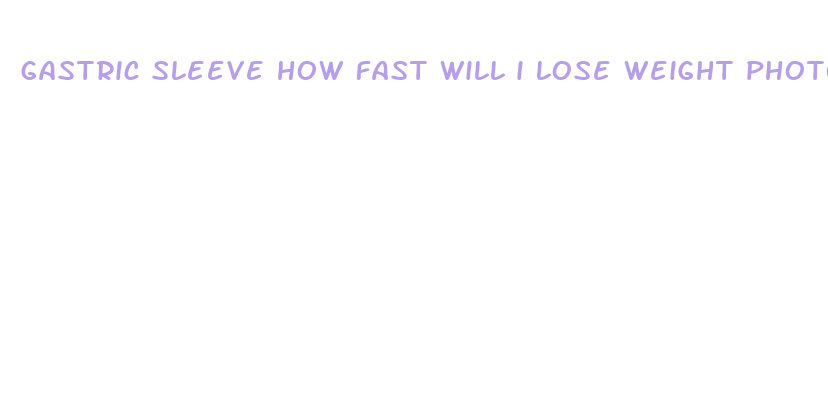 gastric sleeve how fast will i lose weight photos