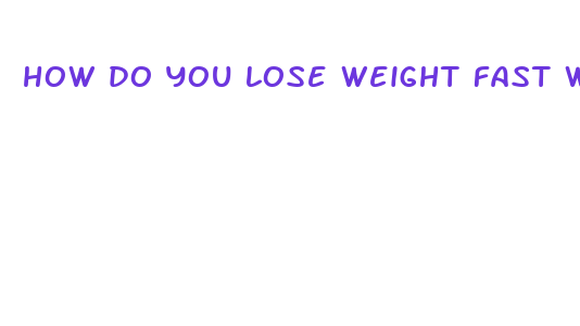 how do you lose weight fast without exercise