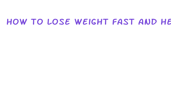 how to lose weight fast and healthy without exercise