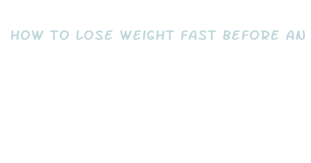 how to lose weight fast before an operation