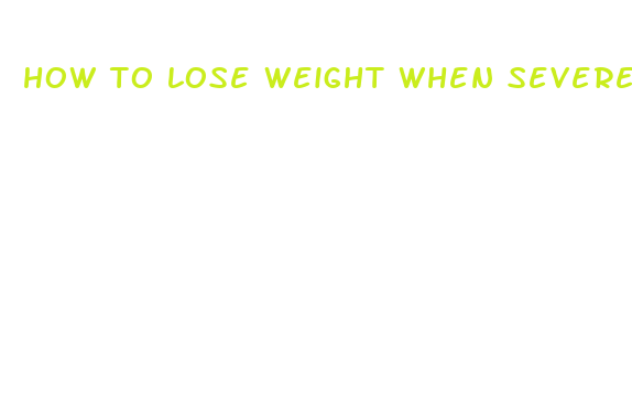 how to lose weight when severely obese