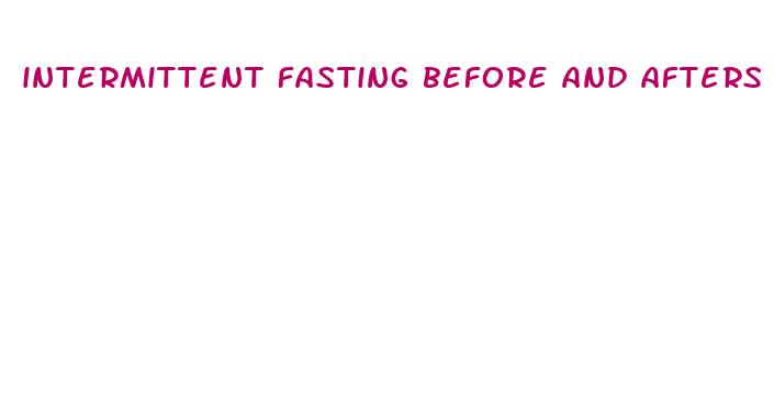 intermittent fasting before and afters