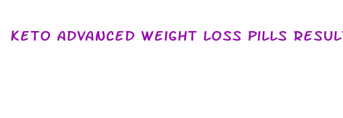 keto advanced weight loss pills results