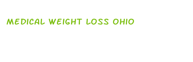 medical weight loss ohio