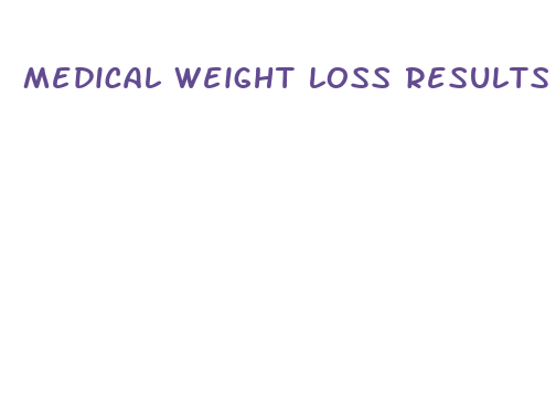 medical weight loss results