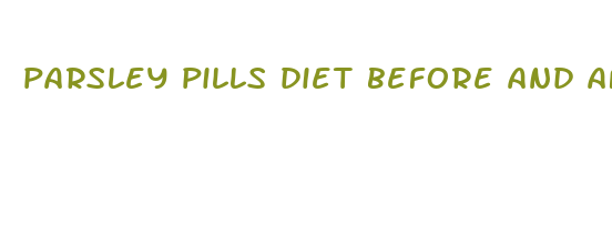 parsley pills diet before and after