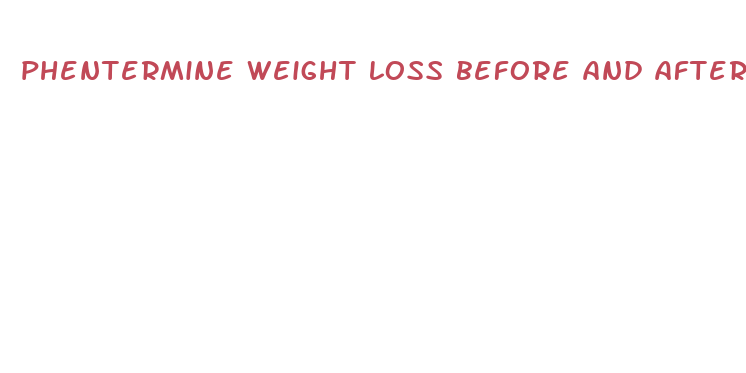 phentermine weight loss before and after