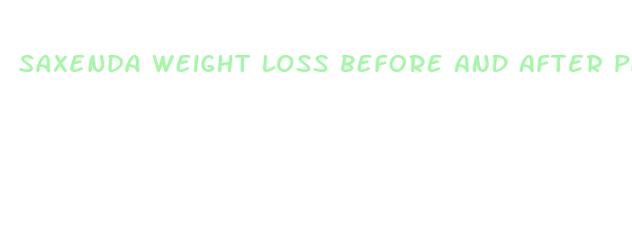 saxenda weight loss before and after pictures