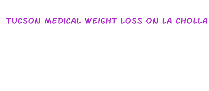 tucson medical weight loss on la cholla