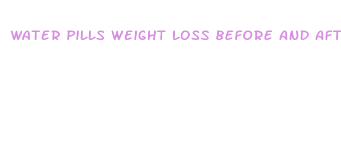 water pills weight loss before and after