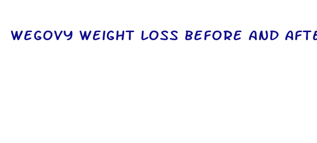 wegovy weight loss before and after